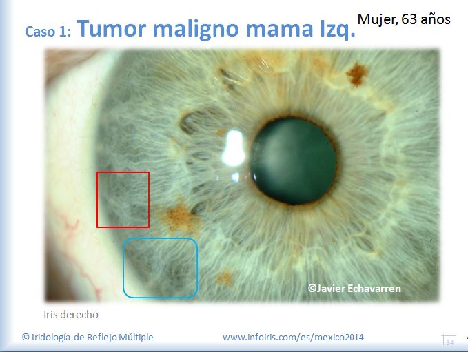 Image module