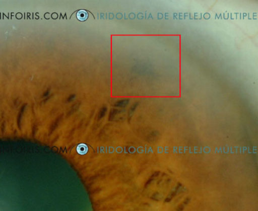 Cambios en el Iris (Ej.2)