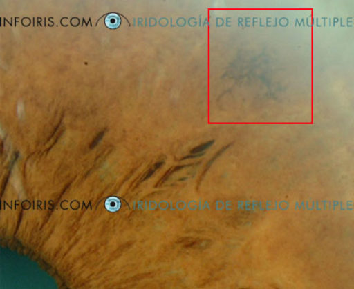 Modificazioni iridee (Es.2)