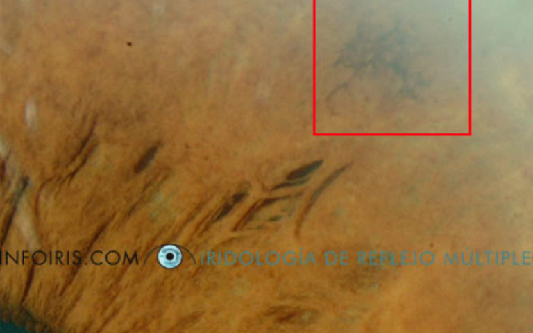 Modificazioni iridee (Es.2)