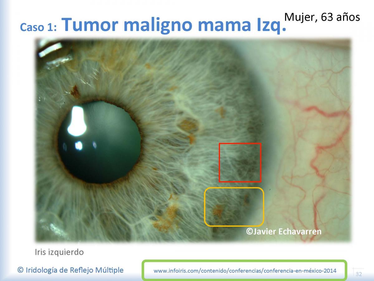 Image module