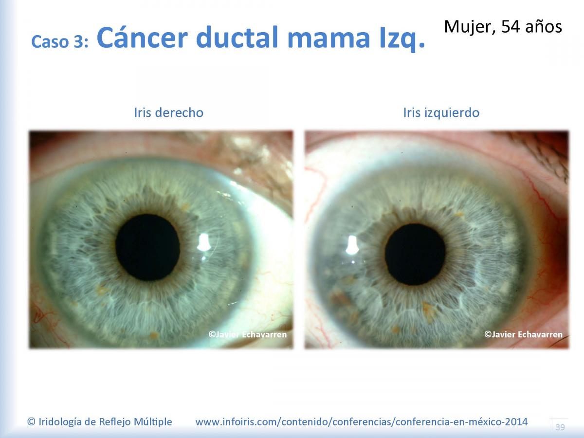 Image module