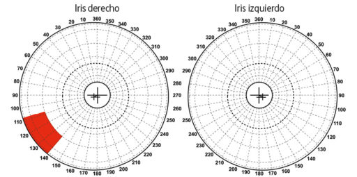Zona Topográfica del Hígado