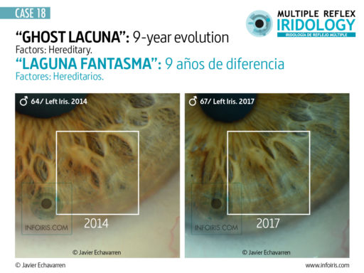 Signo del iris: Laguna. 9 años de diferencia.