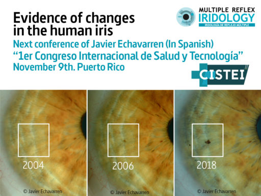 Next conference: Evidence of changes in the human iris.