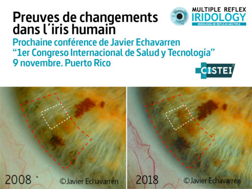 Prochaine conférence: Preuves de changements dans l&rsquo;iris humain.
