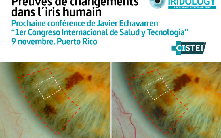Prochaine conférence: Preuves de changements dans l&rsquo;iris humain.