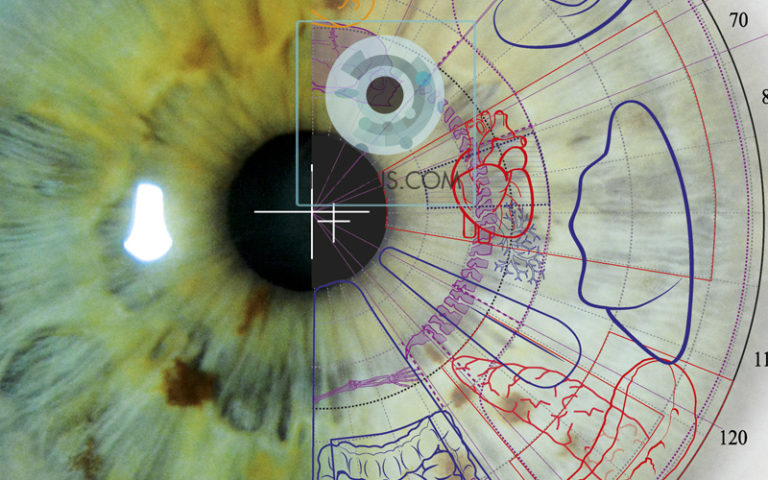 El fenómeno de Reflejo Múltiple