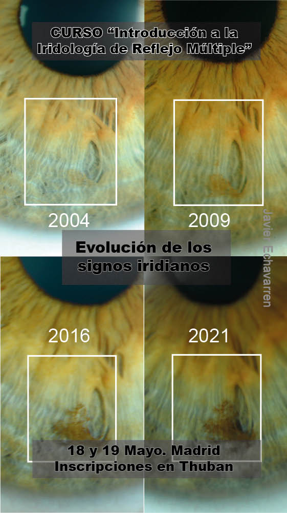 Evolución de una Pigmentación en una Laguna a lo largo de los años.